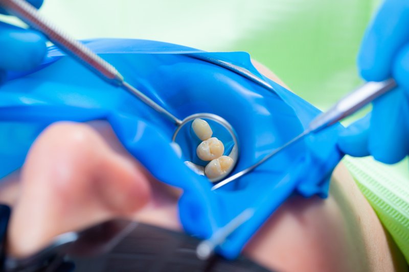 a dentist performing a root canal on a patient